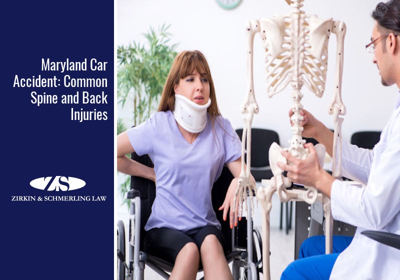 Common Back Injuries From Car Accidents in Maryland