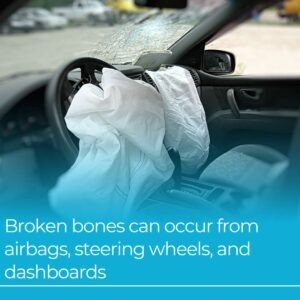 from airbags, steering wheel, dash board