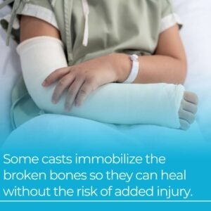 how casts work