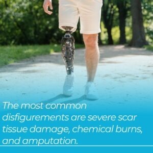 most common disfigurements