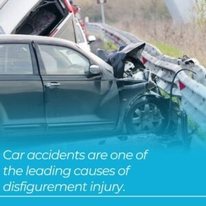 car accidents as leading cause