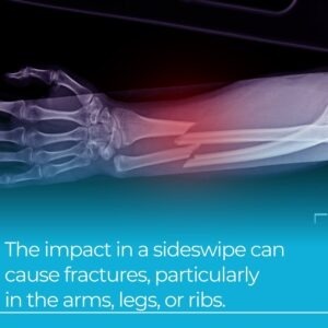 impact of sideswipe fractures