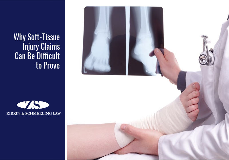 Why Soft-Tissue Injury Claims Can Be Difficult to Prove