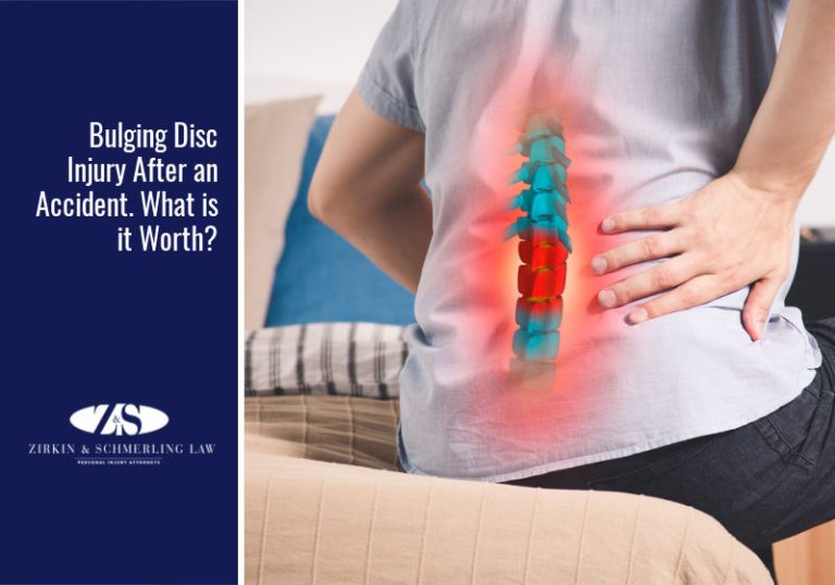 Accident-Related Bulging Disc Injury. What Does It Cost?
