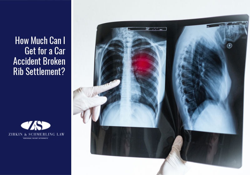 How Much Can I Get for a Car Accident Broken Rib Settlement?