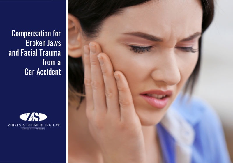 Compensation for Broken Jaws and Facial Trauma from a Car Accident