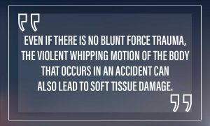 blunt force trauma