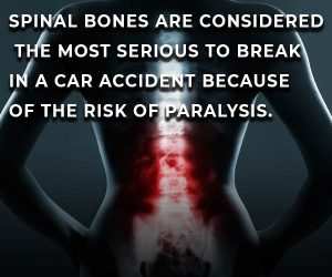 spinal bones