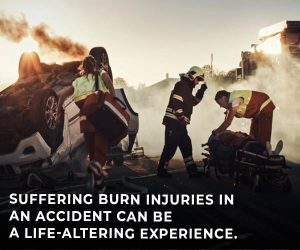 burn injury is life-altering