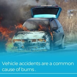vehicle accident as a cause