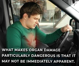 internal organ injury not immediately apparent
