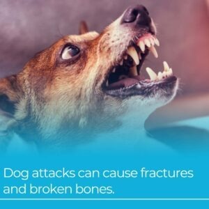 dog attacks