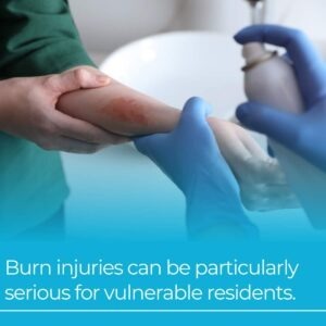 burn injuries group home