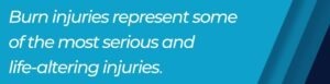 burn injuries