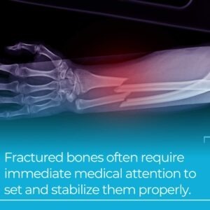 fractured bones
