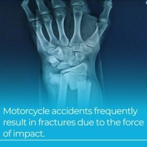 motorcycle accident fractures