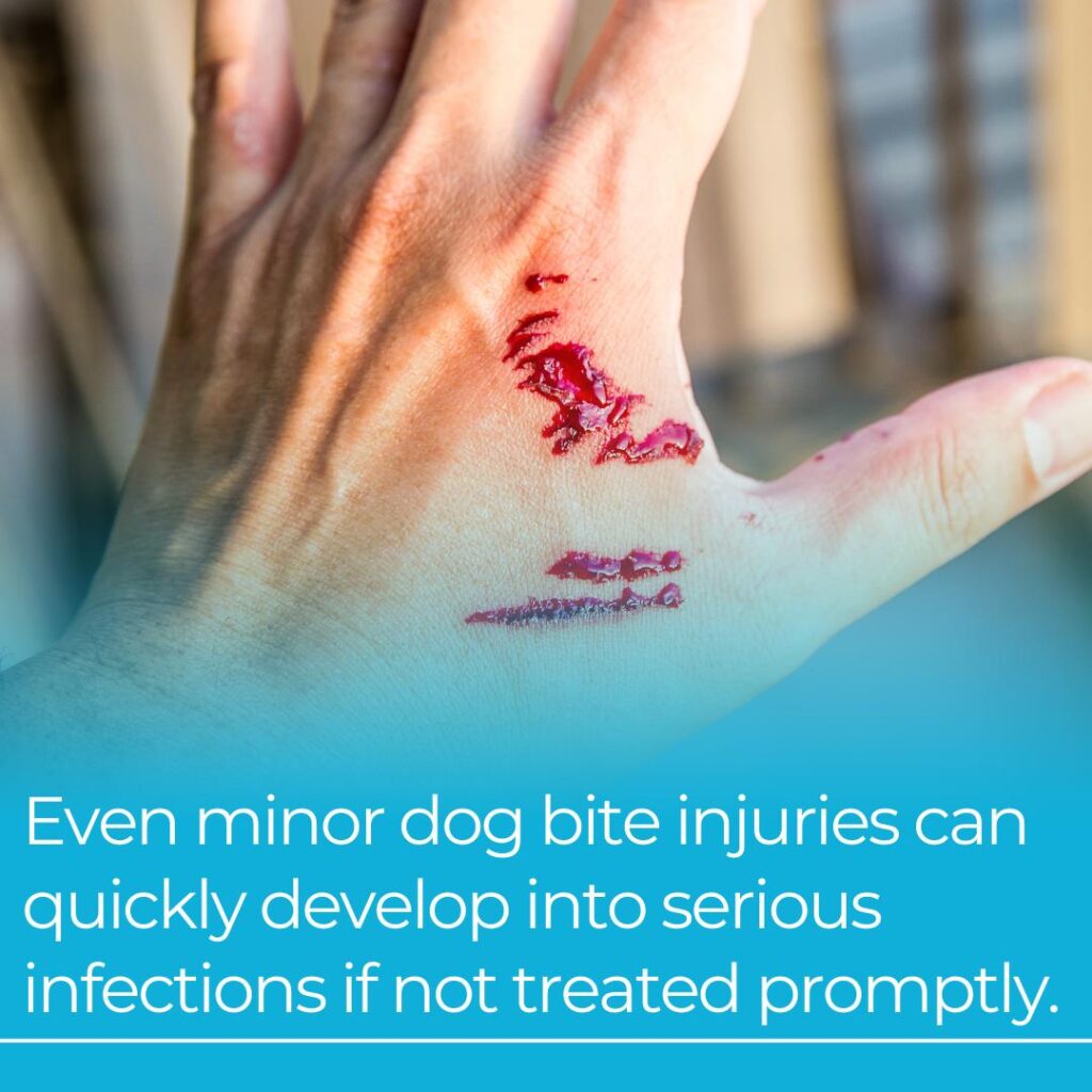 Minor dog bite injury lawyer